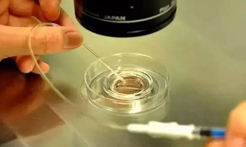 上海试管供卵代怀：﻿试管婴儿移植后尽量别憋尿，作用不大还可能会影响胚胎